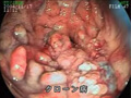 FS-06 Digestive System